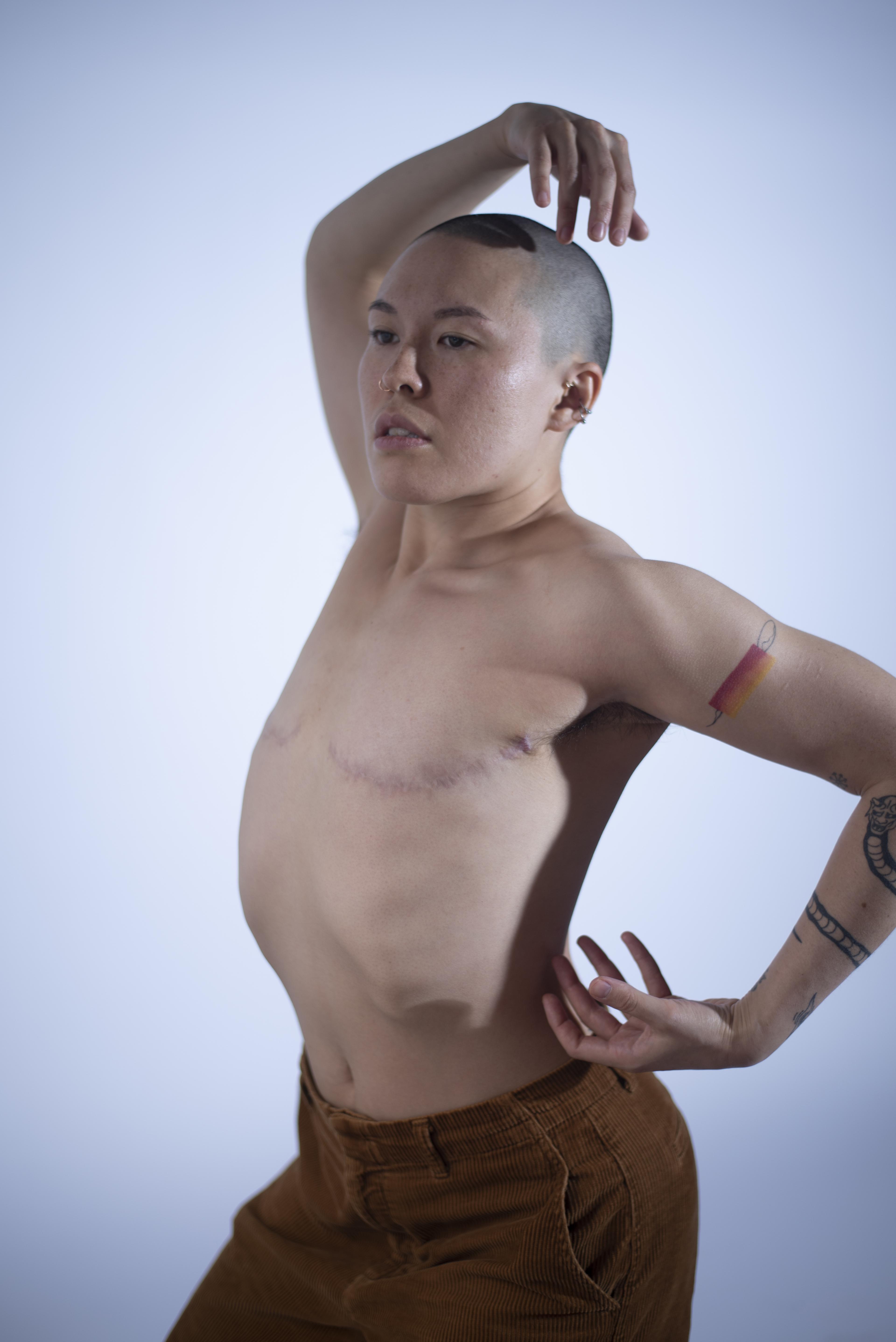 A performance still from post-op