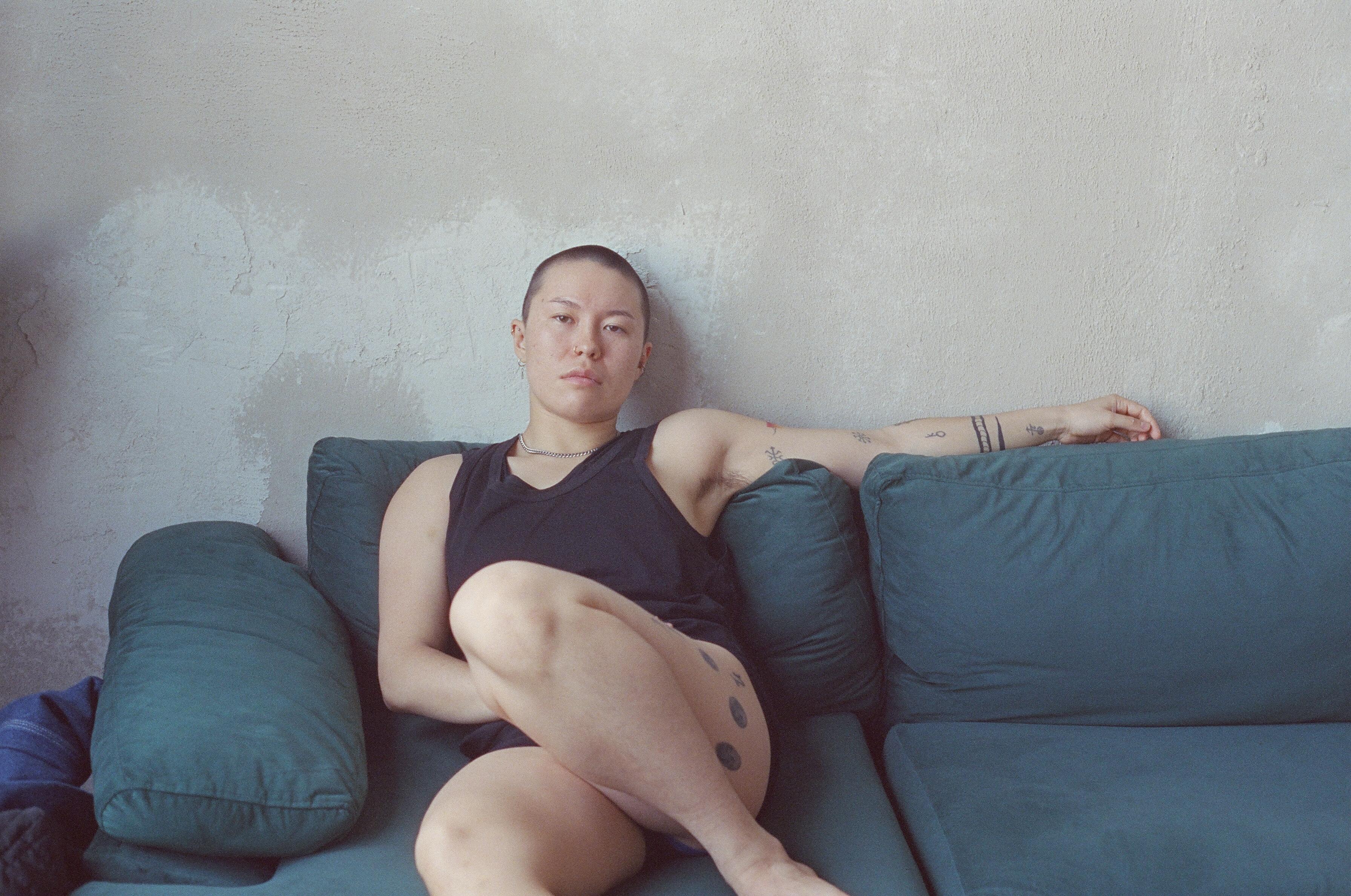 A performance still from pre-surgery